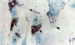 Rickettsia prowazekii